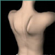 Winging Scapula is nerve damage